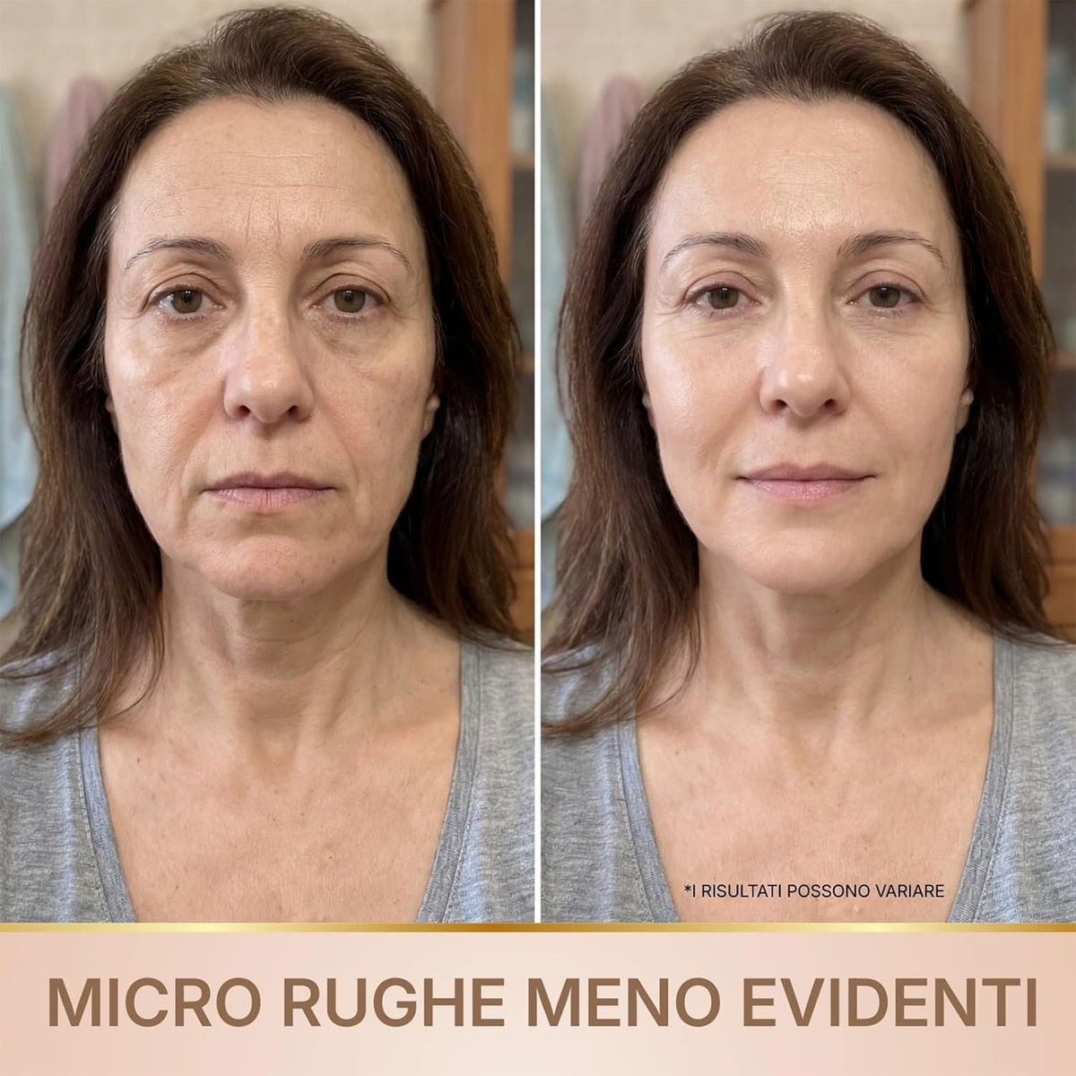 Siero Coreano al Collagene – Firasy Paris Glow
